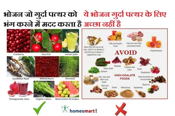 kidney stone diet chart in hindi