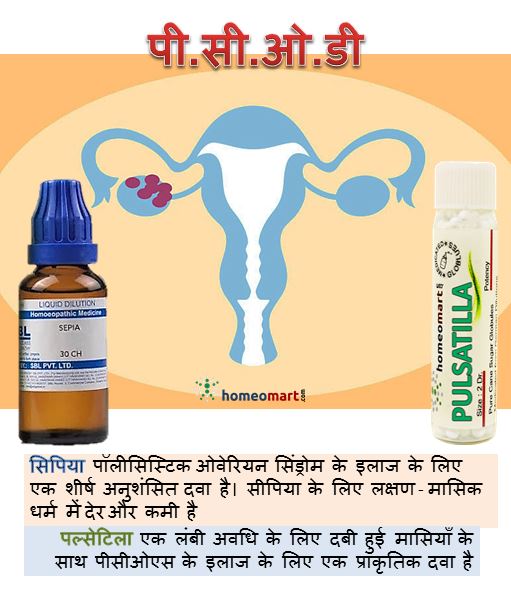 Image of a uterus with polycystic ovaries and homeopathic medicines in hindi, pcod ka ilaj upachar